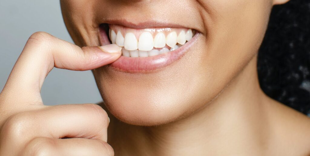 smiling woman with white teeth