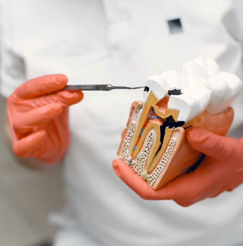 Hygienist educating about oral health with a mock up of tooth in the jaw