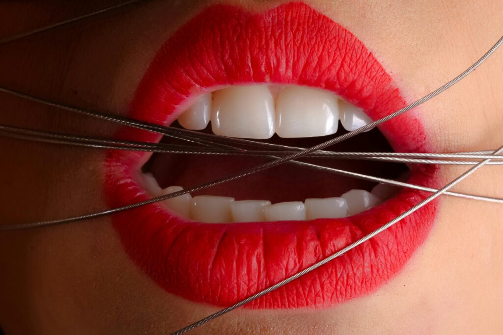 image of female mouth wearing bright red lipstick and holding sharp needles between exposed teeth to symbolise toothache