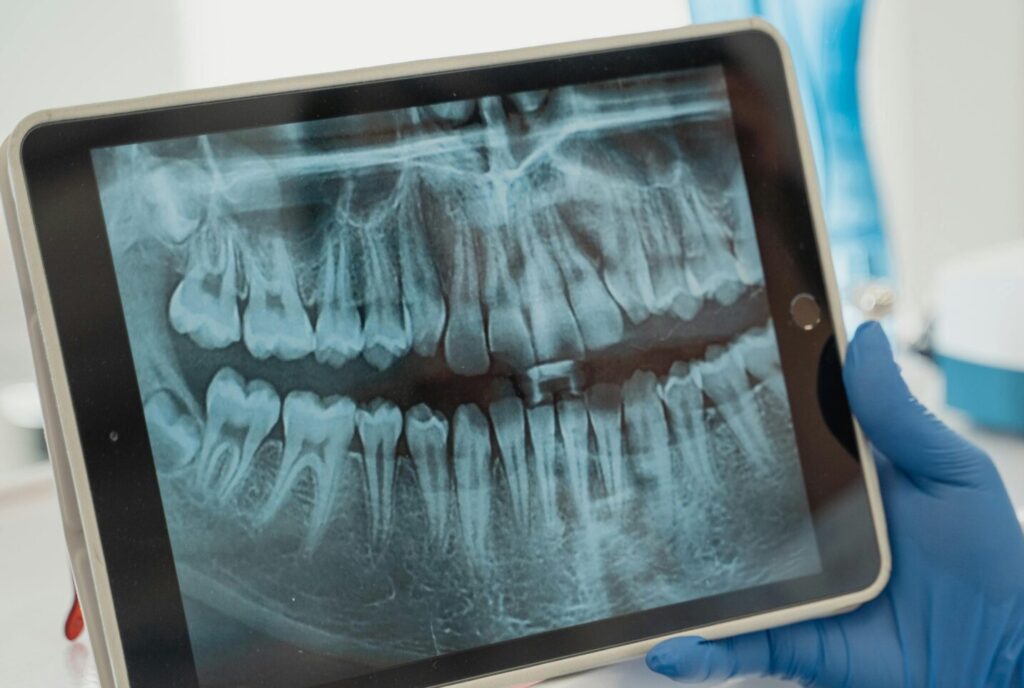 panoramic dental x-ray